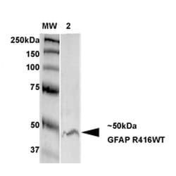 Glial Fibrillary Acidic Protein (GFAP) Monoclonal Antibody (S206B-9), QED Bioscience 100 &mu;g | Buy Online | Leinco Technologies Inc | Fisher Scientific