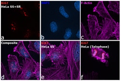 Invitrogen Ki-67 Monoclonal Antibody (SolA15), Alexa Fluor 532, eBioscience