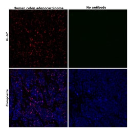 Invitrogen Ki-67 Monoclonal Antibody (SolA15), Alexa Fluor 532, eBioscience