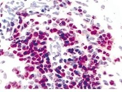 CXCR3 (CD183) Monoclonal Antibody (1C6), Abbomax 100 &mu;g; Unconjugated:Antibodies,