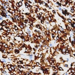 BCAR3 Polyclonal Antibody, Abbomax 100 &mu;g | Buy Online | Abbomax Inc | Fisher Scientific