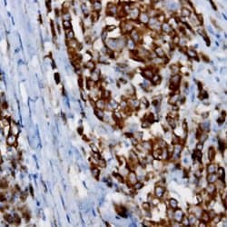 BCAR3 Polyclonal Antibody, Abbomax 100 &mu;g; Unconjugated:Antibodies,