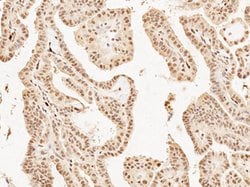 Mash1/Ascl1 Polyclonal Antibody, Rockland:Antibodies:Primary Antibodies