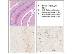 Doublecortin Polyclonal Antibody, Rockland:Antibodies:Primary Antibodies
