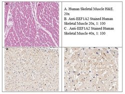 EEF1A2 Polyclonal Antibody, Rockland 100 &mu;g; Unconjugated:Antibodies,