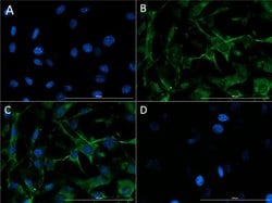 Collagen Type IV Polyclonal Antibody, Rockland 100 &mu;g; Unconjugated:Antibodies,