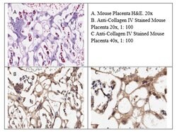 Collagen Type IV Polyclonal Antibody, Rockland 100 &mu;g; Unconjugated:Antibodies,