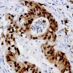Phospho-ER (Ser167) Polyclonal Antibody, Abbomax 100 &mu;g; Unconjugated:Antibodies,