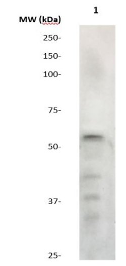 Phospho-ER (Ser167) Polyclonal Antibody, Abbomax 100 &mu;g; Unconjugated:Antibodies,