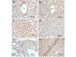 Collagen Type I Polyclonal Antibody, Rockland:Antibodies:Primary Antibodies