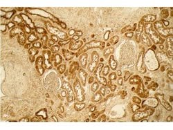 Collagen Type I Polyclonal Antibody, Rockland:Antibodies:Primary Antibodies