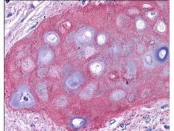Collagen Type II Polyclonal Antibody, Rockland:Antibodies:Primary Antibodies