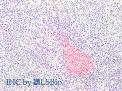 Collagen Type III Polyclonal Antibody, Rockland 100 &mu;g; Unconjugated:Antibodies,