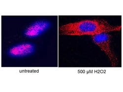 Telomerase catalytic subunit Polyclonal Antibody, Rockland:Antibodies:Primary