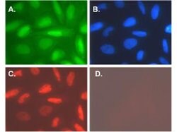 Telomerase catalytic subunit Polyclonal Antibody, Rockland:Antibodies:Primary