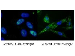 Telomerase catalytic subunit Polyclonal Antibody, Rockland:Antibodies:Primary