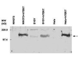 Telomerase catalytic subunit Polyclonal Antibody, Rockland:Antibodies:Primary