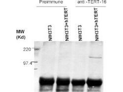 Telomerase catalytic subunit Polyclonal Antibody, Rockland:Antibodies:Primary