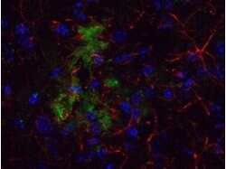 beta Amyloid Polyclonal Antibody, Rockland:Antibodies:Primary Antibodies