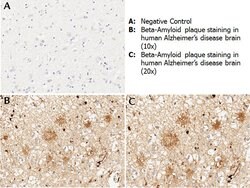 beta Amyloid Polyclonal Antibody, Rockland:Antibodies:Primary Antibodies