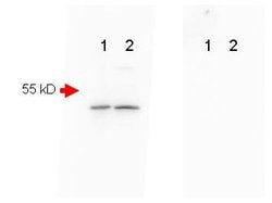 beta Amyloid Polyclonal Antibody, Rockland:Antibodies:Primary Antibodies