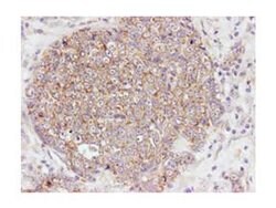 Phospho-AKT (Ser473) Polyclonal Antibody, Rockland 100 &mu;g; Unconjugated:Antibodies,