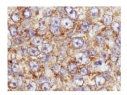 Phospho-AKT (Ser473) Polyclonal Antibody, Rockland 100 &mu;g; Unconjugated:Antibodies,
