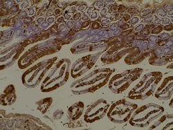 RFP Pre-adsorbed Polyclonal Antibody, Rockland 100 &mu;g; Unconjugated:Antibodies,