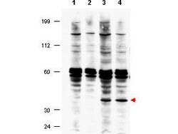 FANCFRabbit anti-Chimpanzee, Human, Polyclonal, Rockland 100 &mu;g; Unconjugated:Antibodies,