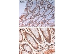 Phospho-Aurora Kinase B (Thr232) Polyclonal Antibody, Rockland 100 &mu;g;