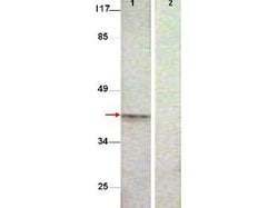 Phospho-Aurora Kinase B (Thr232) Polyclonal Antibody, Rockland 100 &mu;g;