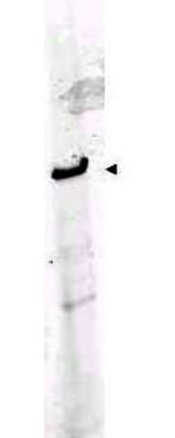 ROBO-1 Polyclonal Antibody, Rockland:Antibodies:Primary Antibodies