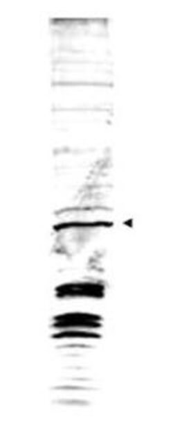 Swi6Rabbit anti-Yeast, Polyclonal, Rockland 100 μg; Unconjugated:Antibodies,