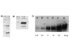 Lysine Acetylated Polyclonal Antibody, Rockland 100 μg; Unconjugated:Antibodies,