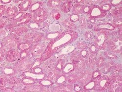 ABCB1 Polyclonal Antibody, Rockland:Antibodies:Primary Antibodies