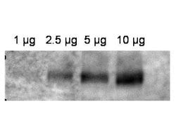 ABCB1 Polyclonal Antibody, Rockland:Antibodies:Primary Antibodies