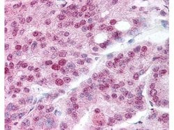 Acetyl-HSP90 (Lys294) Polyclonal Antibody, Rockland 25 &mu;L; Unconjugated:Antibodies,