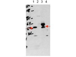 THRA Polyclonal Antibody, Rockland 25 &mu;L; Unconjugated:Antibodies, Polyclonal
