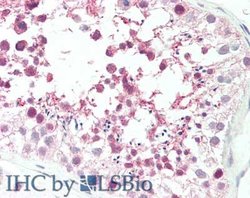 MLF1IP / PBIP1 Polyclonal Antibody, Rockland 100 &mu;g; Unconjugated:Antibodies,