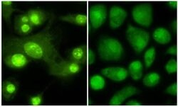 Thyroid Hormone Receptor beta 1 Polyclonal Antibody, Rockland 100 &mu;g;