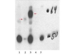 Thyroid Hormone Receptor beta 1 Polyclonal Antibody, Rockland 100 &mu;g;