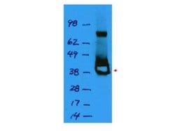 Lac I Polyclonal Antibody, Rockland 100 &mu;g; Unconjugated:Antibodies,