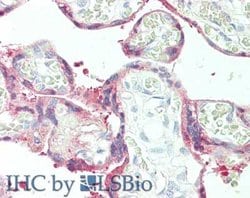 Plasminogen Activator Inhibitor 2 Polyclonal Antibody, Rockland:Antibodies:Primary
