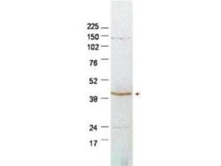 Plasminogen Activator Inhibitor 2 Polyclonal Antibody, Rockland:Antibodies:Primary