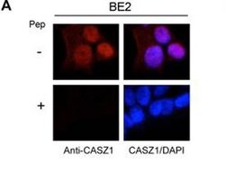 CASZ1 Polyclonal Antibody, Rockland 25 &mu;L; Unconjugated:Antibodies,