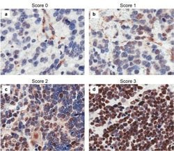 CASZ1 Polyclonal Antibody, Rockland 25 &mu;L; Unconjugated:Antibodies,