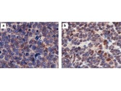 CASZ1 Polyclonal Antibody, Rockland 25 &mu;L; Unconjugated:Antibodies,