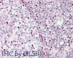 CTCF Polyclonal Antibody, Rockland 25 &mu;L; Unconjugated:Antibodies, Polyclonal