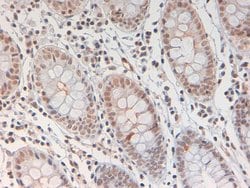 Phospho-STAT3 (Tyr705) Polyclonal Antibody, Rockland 25 &mu;L; Unconjugated:Antibodies,
