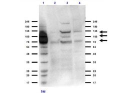Integrin beta 3 Polyclonal Antibody, Rockland 100 &mu;g; Unconjugated:Antibodies,